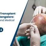 Best Hair Transplant Clinic in Bangalore