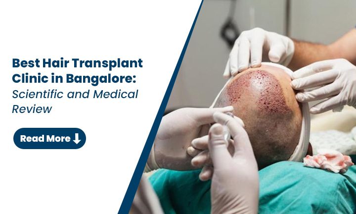 Best Hair Transplant Institute in Bangalore