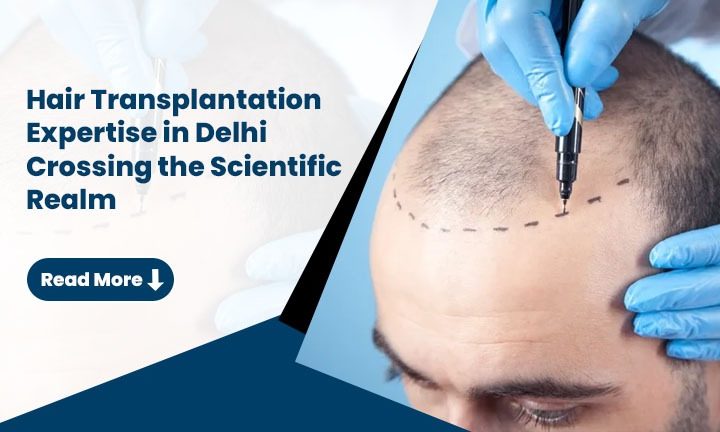 Hair Transplantation