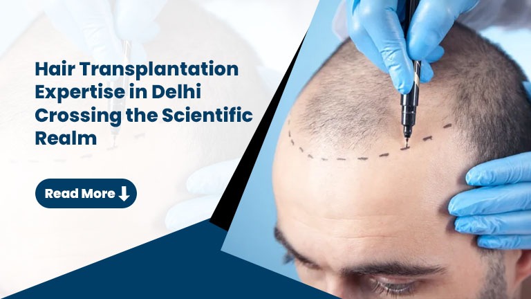 Hair Transplantation